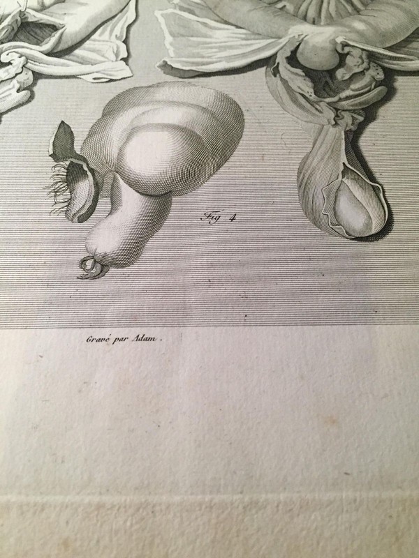RARE 1823 10X16 Medical Engraving LAID PAPER Antonio Scarpa HERNIA Male Parts gallery