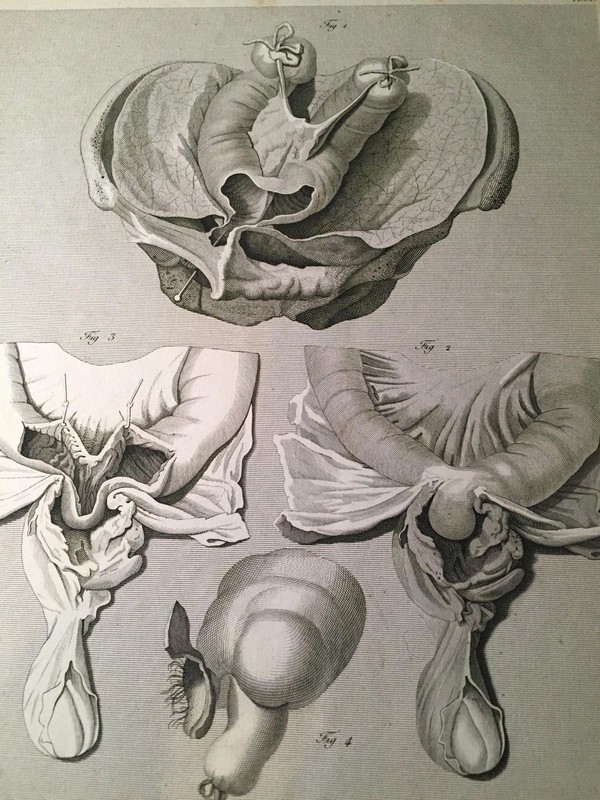RARE 1823 10X16 Medical Engraving LAID PAPER Antonio Scarpa HERNIA Male Parts gallery