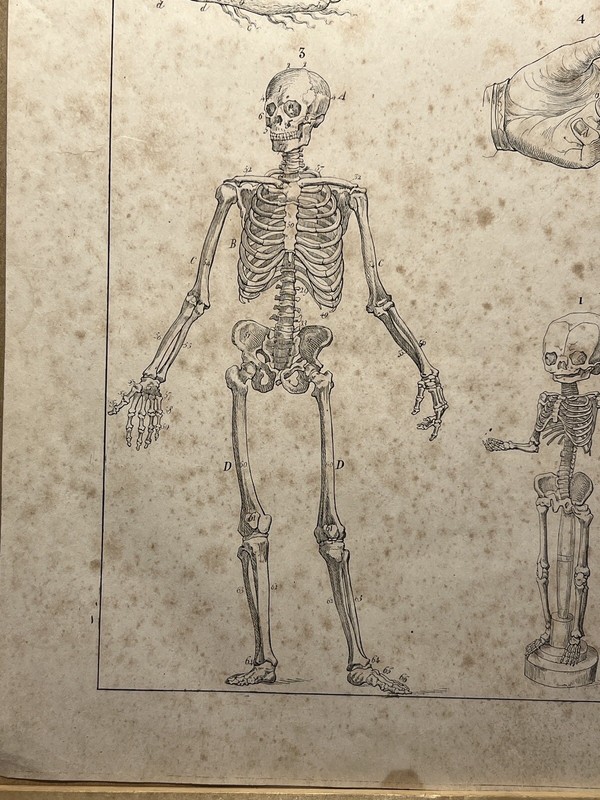 ANTIQUARIAN LITHOGRAPH 1833 SKELETON SKULL ANATOMY ANTHROPOLOGY BONE gallery